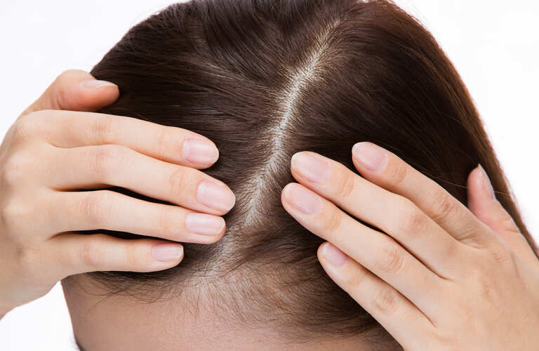 分け目を変える手間を省略 | 大阪のヘアタトゥーならscalpsalon Dr.era